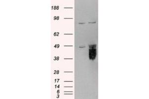 Western Blotting (WB) image for anti-Tissue Factor Pathway Inhibitor (Lipoprotein-Associated Coagulation Inhibitor) (TFPI) (C-Term) antibody (ABIN2465317) (TFPI anticorps  (C-Term))