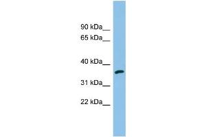 WB Suggested Anti-AKR1C2 Antibody Titration: 0. (AKR1C2 anticorps  (N-Term))