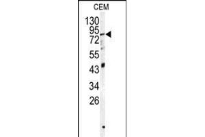 Western blot analysis of PSS1 antibody (N-term K9) (ABIN1882107 and ABIN2839313) in CEM cell line lysates (35 μg/lane).