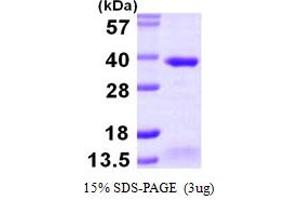 SDS-PAGE (SDS) image for AlkB, Alkylation Repair Homolog 2 (ALKBH2) (AA 1-261) protein (His tag) (ABIN667421)