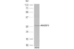 Lane 1:A549 lysates probed with Rabbit Anti-RASSF3 Polyclonal Antibody, Unconjugated  at 1:5000 for 90 min at 37˚C. (RASSF3 anticorps  (AA 51-150))