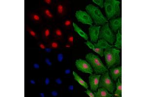 ABIN6257409 and ABIN6273693 staining  cells by IF/ICC. (PAK1IP1 anticorps  (C-Term))