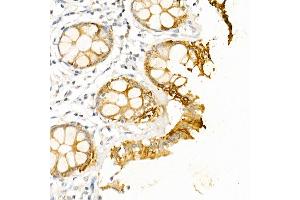 Immunohistochemistry of paraffin-embedded human colon using Cytokeratin 19 (KRT19) Rabbit pAb (ABIN3020778, ABIN3020779, ABIN3020780 and ABIN6213719) at dilution of 1:50 (40x lens). (Cytokeratin 19 anticorps  (AA 241-400))