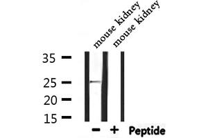 Western blot analysis of extracts from mouse kidney, using RAB32 Antibody.
