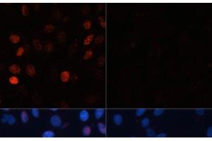 Immunofluorescence analysis of C6 cells using Phospho-γH2A. (gamma H2AX anticorps  (pSer139))