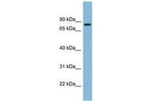 Image no. 1 for anti-Erythrocyte Membrane Protein Band 4.1 (Elliptocytosis 1, RH-Linked) (EPB41) (AA 107-156) antibody (ABIN6742061) (EPB41 anticorps  (AA 107-156))