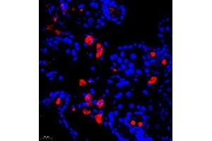 Immunofluorescence of paraffin embedded mouse breast using Calcitonin (ABIN7073271) at dilution of 1:650 (400x lens) (Calcitonin anticorps)