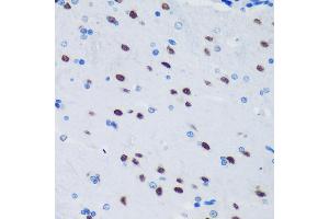 Immunohistochemistry of paraffin-embedded Rat brain using PSPC1 Rabbit pAb (ABIN6132925, ABIN6146363, ABIN6146364 and ABIN6224928) at dilution of 1:100 (40x lens).