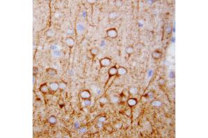 Anti-CaMKK antibody, IHC(P) IHC(P): Rat Brain Tissue (CAMKK1 anticorps  (N-Term))