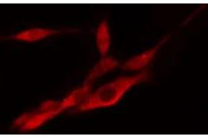 ABIN6274333 staining COLO205 cells by IF/ICC.