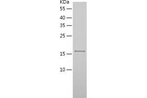Western Blotting (WB) image for Tumor Necrosis Factor (Ligand) Superfamily, Member 15 (TNFSF15) (AA 72-251) protein (His-IF2DI Tag) (ABIN7125531)