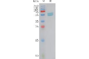 Human I Protein, hFc Tag on SDS-PAGE under reducing condition.