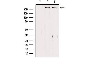 Western blot analysis of extracts from various samples, using ASPM Antibody.