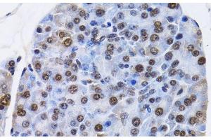 Immunohistochemistry of paraffin-embedded Mouse pancreas using ID3 Polyclonal Antibody at dilution of 1:200 (40x lens).