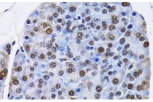 Immunohistochemistry of paraffin-embedded Mouse pancreas using ID3 Polyclonal Antibody at dilution of 1:200 (40x lens). (ID3 anticorps)