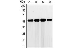 Western blot analysis of G3BP2 expression in HEK293T (A), RT4 (B), Jurkat (C), K562 (D) whole cell lysates.