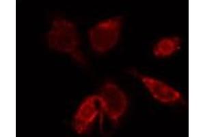 ABIN6274000 staining HepG2 by IF/ICC. (CCR9 anticorps  (C-Term))