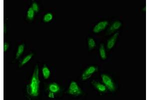Immunofluorescent analysis of Hela cells using ABIN7155905 at dilution of 1:100 and Alexa Fluor 488-congugated AffiniPure Goat Anti-Rabbit IgG(H+L) (LIPE anticorps  (AA 1-251))
