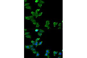 Immunofluorescence analysis of MCF-7 cells using GLUL antibody (ABIN5973158). (GLUL anticorps)