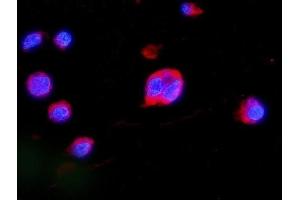 IF analysis of MEK2/MAP2K2 using anti-MEK2/MAP2K2 antibody (ABIN7599357).