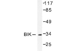 Image no. 1 for anti-BCL2-Interacting Killer (Apoptosis-Inducing) (BIK) antibody (ABIN265329) (BIK anticorps)
