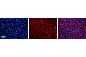 RHOD antibody - C-terminal region          Formalin Fixed Paraffin Embedded Tissue:  Human Liver Tissue    Observed Staining:  Cytoplasm in sinusoids of liver   Primary Antibody Concentration:  1:100    Other Working Concentrations:  1/600    Secondary Antibody:  Donkey anti-Rabbit-Cy3    Secondary Antibody Concentration:  1:200    Magnification:  20X    Exposure Time:  0.