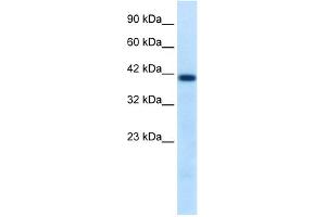 WB Suggested Antibody Titration:  0. (HNF1B anticorps  (N-Term))