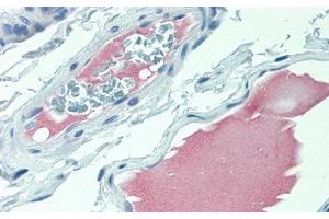 Detection of AngI in Human Colon Tissue using Polyclonal Antibody to Angiotensin I (AngI)