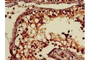 Immunohistochemistry of paraffin-embedded human testis tissue using ABIN7170052 at dilution of 1:100 (ATP1B3 anticorps  (AA 57-279))