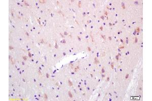 Formalin-fixed and paraffin embedded rat brain labeled with Anti-KAT2B/ GCN5/PCAF Polyclonal Antibody, Unconjugated (ABIN755287) at 1:200 followed by conjugation to the secondary antibody and DAB staining. (KAT2B anticorps  (AA 451-550))