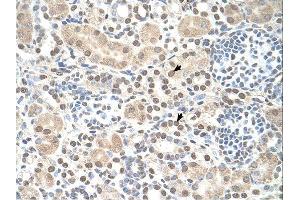 ST8SIA2 antibody was used for immunohistochemistry at a concentration of 4-8 ug/ml. (ST8SIA2 anticorps  (C-Term))