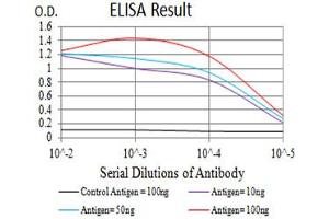 Black line: Control Antigen (100 ng),Purple line: Antigen (10 ng), Blue line: Antigen (50 ng), Red line:Antigen (100 ng)