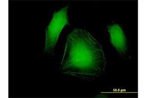 Immunofluorescence of purified MaxPab antibody to LDB3 on HeLa cell.