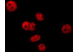ABIN6277282 staining  HepG2 cells by IF/ICC. (PDCD4 anticorps  (N-Term))