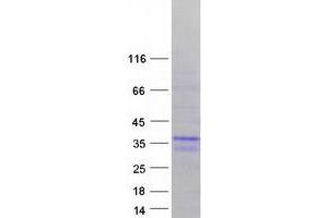 Validation with Western Blot