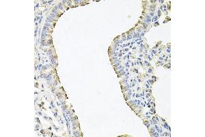 Immunohistochemistry of paraffin-embedded mouse lung using SCNN1G antibody (ABIN6129468, ABIN6147453, ABIN6147454 and ABIN6221724) at dilution of 1:100 (40x lens).