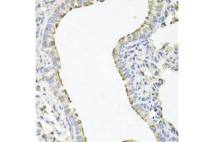 Immunohistochemistry of paraffin-embedded mouse lung using SCNN1G antibody (ABIN6129468, ABIN6147453, ABIN6147454 and ABIN6221724) at dilution of 1:100 (40x lens). (SCNN1G anticorps  (AA 85-355))