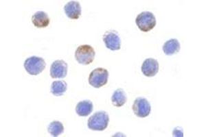 Immunocytochemistry of DDX3 in HepG2 cells with AP30282PU-N DDX3 antibody at 10 μg/ml.