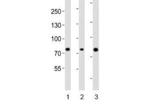 Western blot analysis of lysate from human 1) ovary, 2) placenta and 3) plasma lysate using Integrin beta 8 antibody diluted at 1:1000.