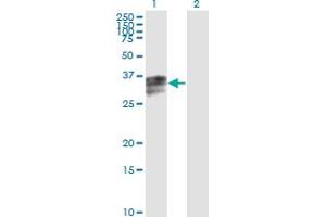 Western Blot analysis of HPX expression in transfected 293T cell line by HPX monoclonal antibody (M01), clone 3A9-1A9.