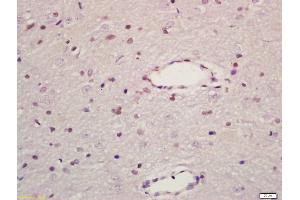 Formalin-fixed and paraffin embedded rat brain labeled with Anti-MAPK8IP1 Polyclonal Antibody, Unconjugated (ABIN716441) at 1:200 followed by conjugation to the secondary antibody and DAB staining