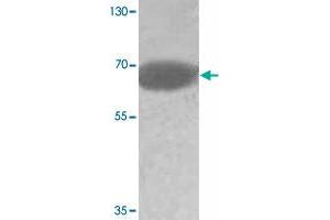 Western blot analysis of human fetal testis tissue lysate with ADAM20 polyclonal antibody  at 1:500 dilution. (ADAM20 anticorps)