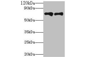 Western blot All lanes: Klkb1 antibody at 2 μg/mL Lane 1: Hela whole cell lysate Lane 2: Rat brain tissue Secondary Goat polyclonal to rabbit IgG at 1/10000 dilution Predicted band size: 72 kDa Observed band size: 72 kDa (KLKB1 anticorps  (AA 391-638))