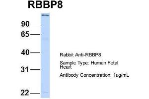 Host:  Rabbit  Target Name:  RBBP8  Sample Type:  Human Fetal Heart  Antibody Dilution:  1. (Retinoblastoma Binding Protein 8 anticorps  (C-Term))