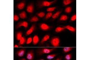 Immunofluorescence analysis of U2OS cells using ZEB1 Polyclonal Antibody (ZEB1 anticorps)