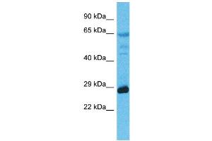 Host:  Rabbit  Target Name:  MED6  Sample Type:  Esophagus Tumor lysates  Antibody Dilution:  1. (MED6 anticorps  (N-Term))