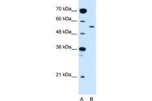 Western Blotting (WB) image for anti-Solute Carrier Family 2 (Facilitated Glucose Transporter), Member 10 (SLC2A10) antibody (ABIN2462768)