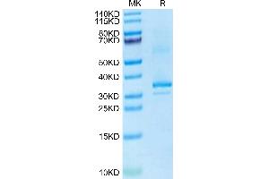 Mouse RANKL on Tris-Bis PAGE under reduced condition. (RANKL Protein (AA 70-316) (His tag))