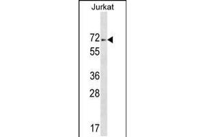 Western blot analysis in Jurkat cell line lysates (35ug/lane). (ZNF613 anticorps  (C-Term))