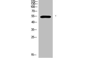Western Blot analysis of 293T cells using primary antibody diluted at 1:500(4 °C overnight). (GCM2 anticorps  (AA 21-70))